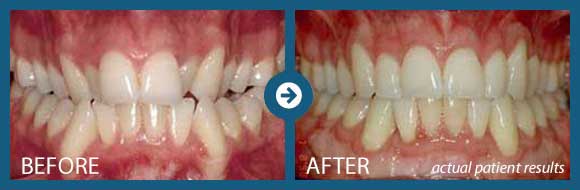 Wilckodontics | orthodontic treatment memphis tn