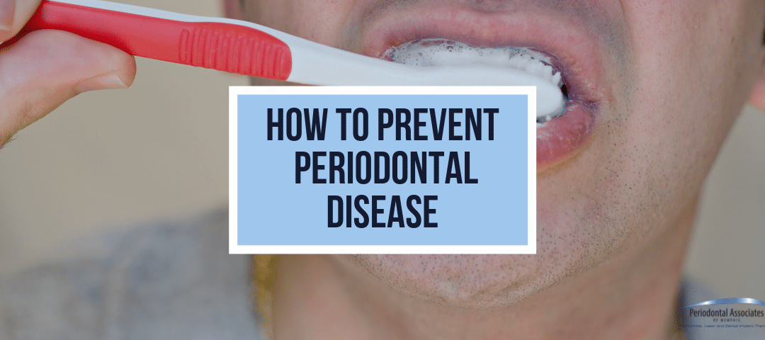 How To Prevent Periodontal Disease