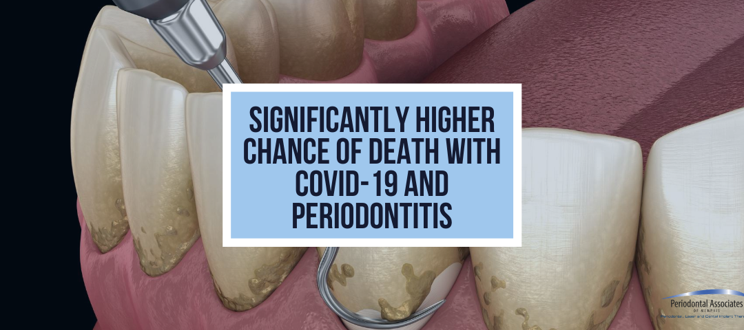 Significantly Higher Chance of Death With COVID-19 and Periodontitis
